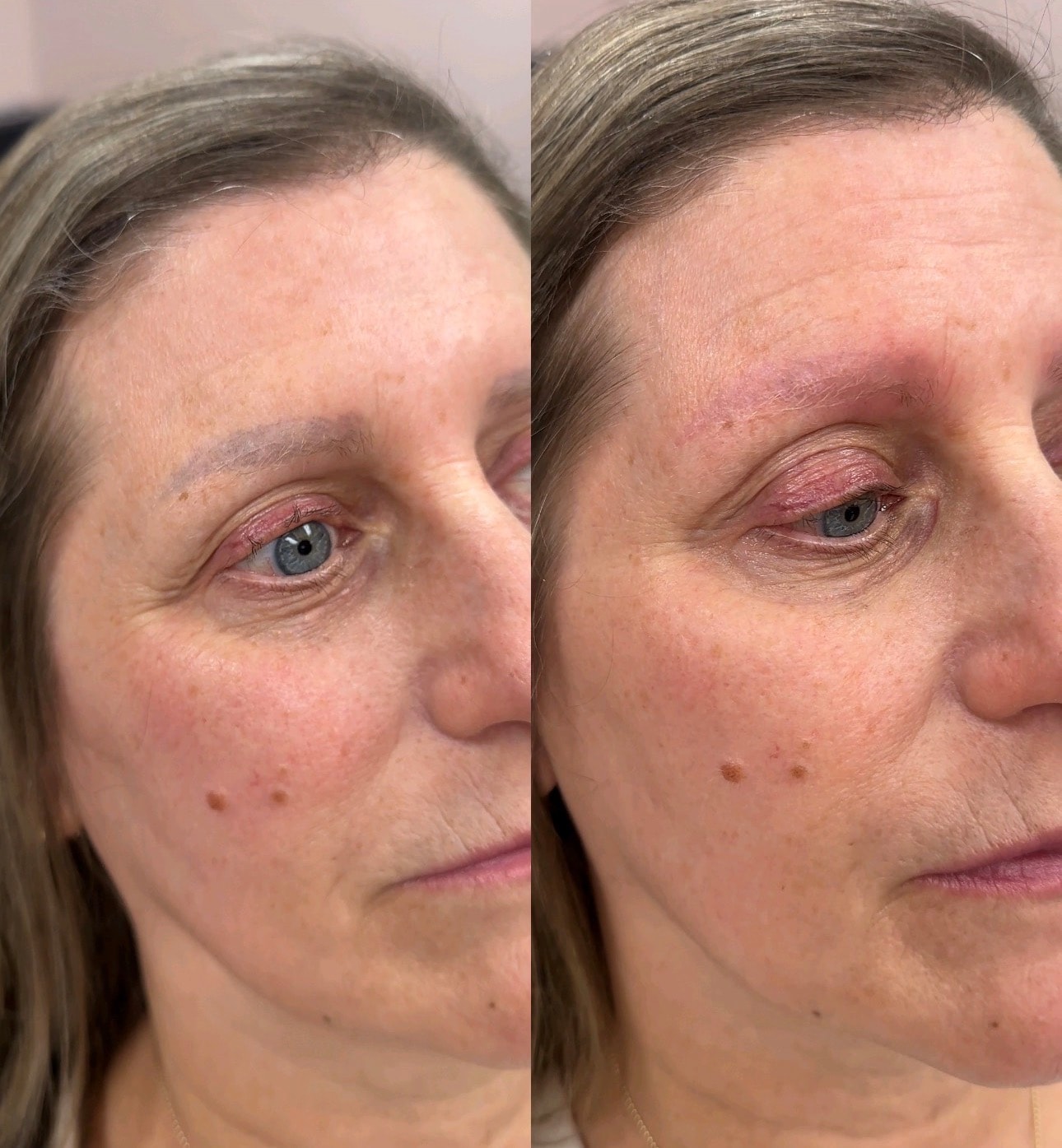 Eyebrows before and after — Brows By Bree