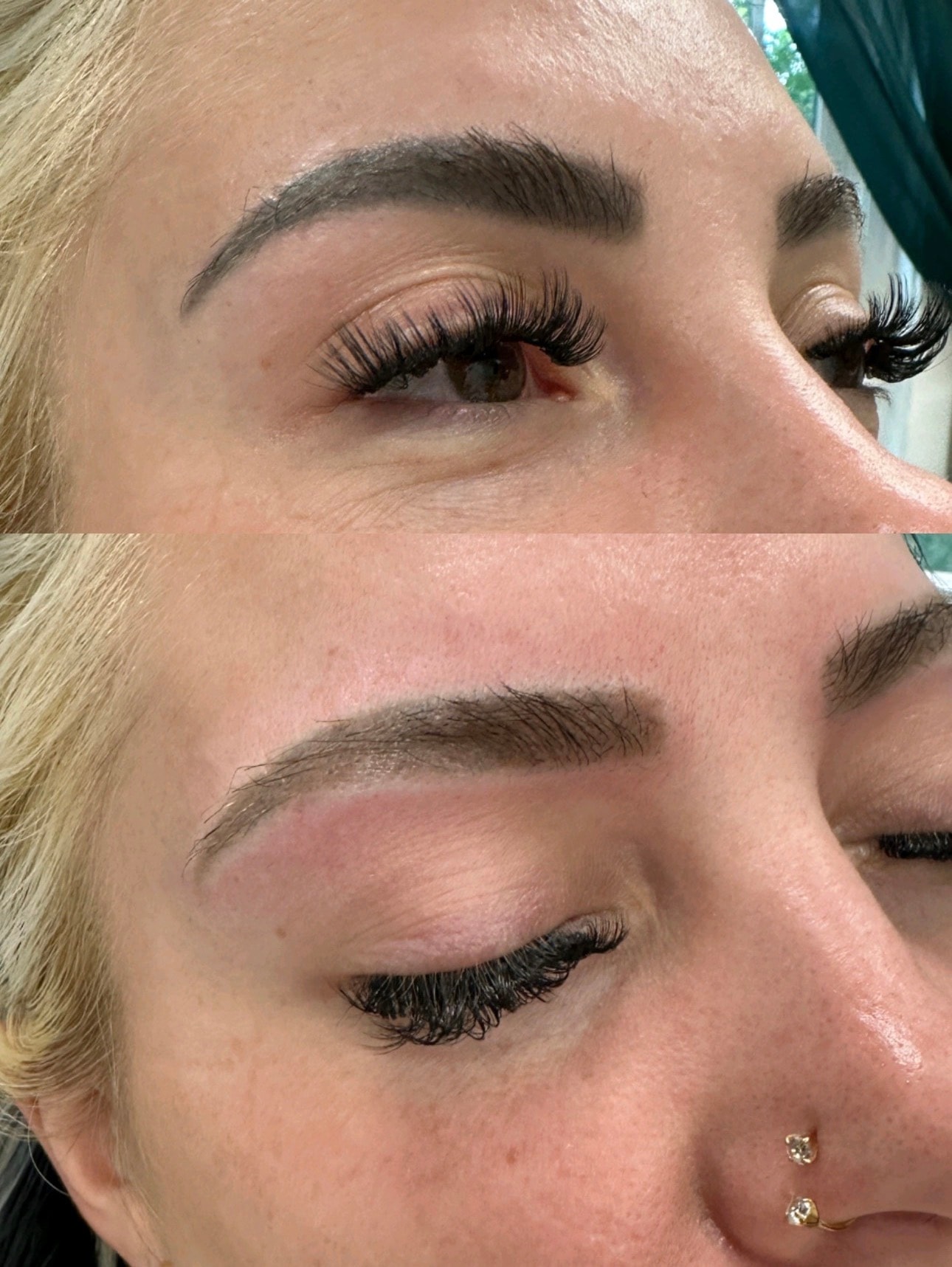 Tattoo removal before and after — Bree & Co.