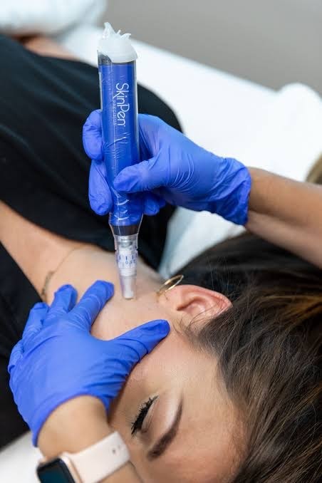 SkinPen microneedling facial treatment — Bree & Co. Horsham PA